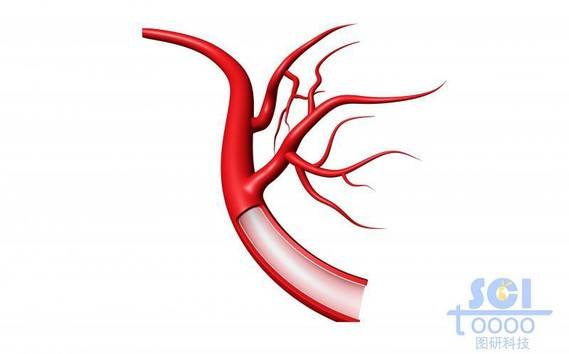 带切口带毛细血管分支的血管结构
