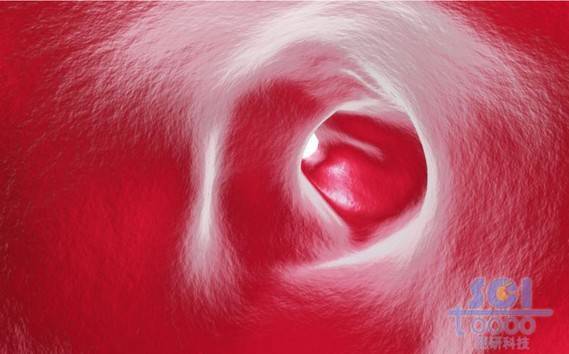 血管內腔結構