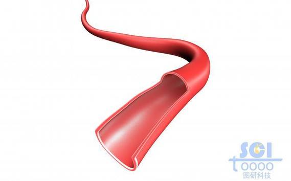 单根弯曲血管前段带切口结构