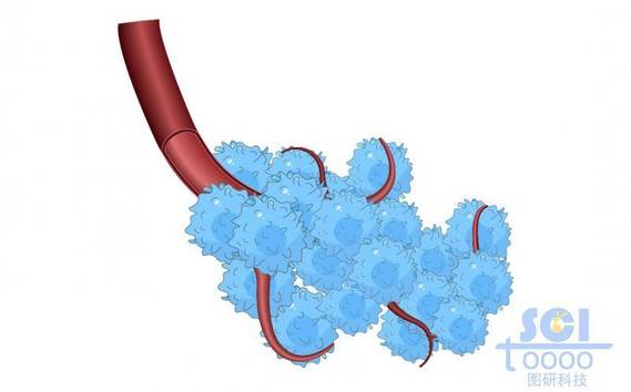 血管与癌细胞群簇