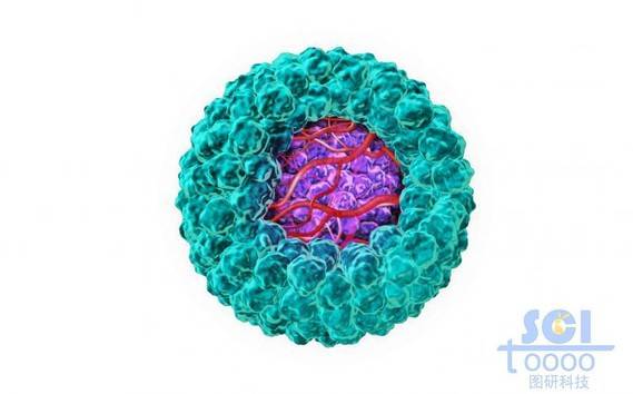 癌细胞包裹的带微血管结构的肿瘤