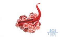 血管与癌细胞群簇